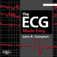 The ECG Made Easy