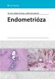 Endometrióza